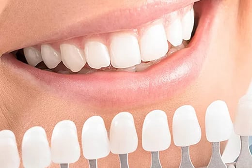 Teeth Whitening: Safe Methods That Really Work